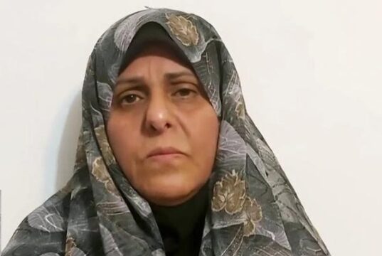 فاطمه سپهری ۱۵ کیلو وزن از دست داده و به‌ کولونوسکوپی فوری نياز دارد!