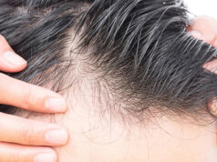 ریزش مو در مردان: عوامل علل و راه‌های موثر درمانی