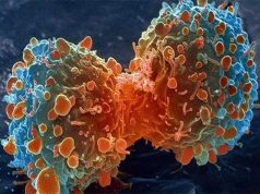 پنج راه ساده برای پیشگیری از سرطان روده بزرگ