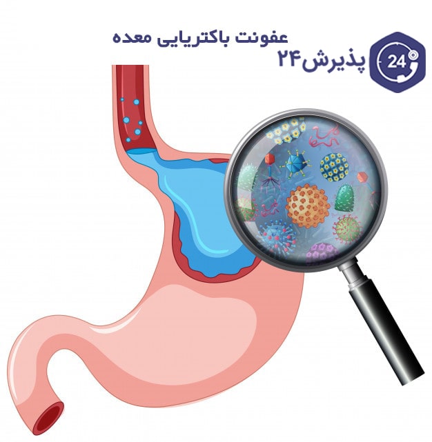 علائم و درمان عفونت باکتریایی معده: راهنمایی جامع برای شناخت و مدیریت