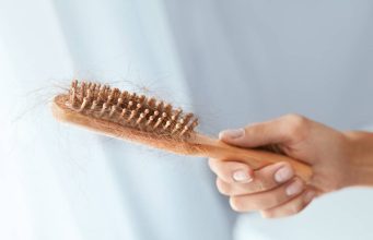 5 راه برای جلوگیری از ریزش مو بدون درمان یا آماده سازی